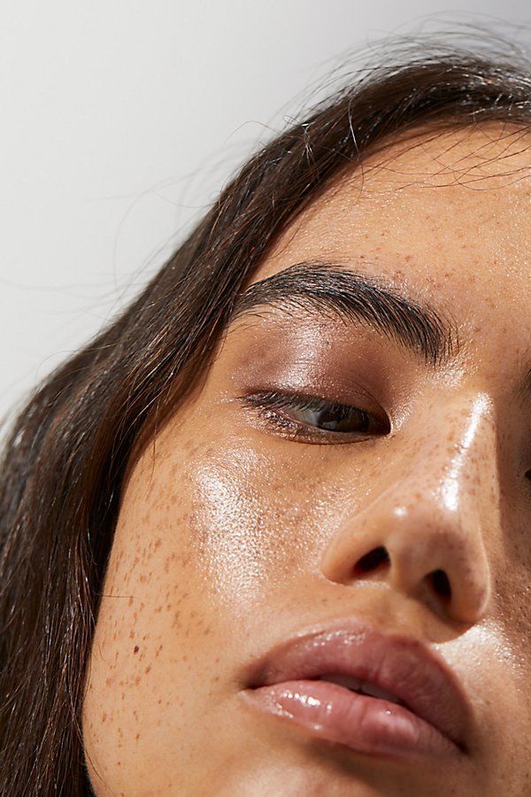 Dark Spots & Pigmentation
