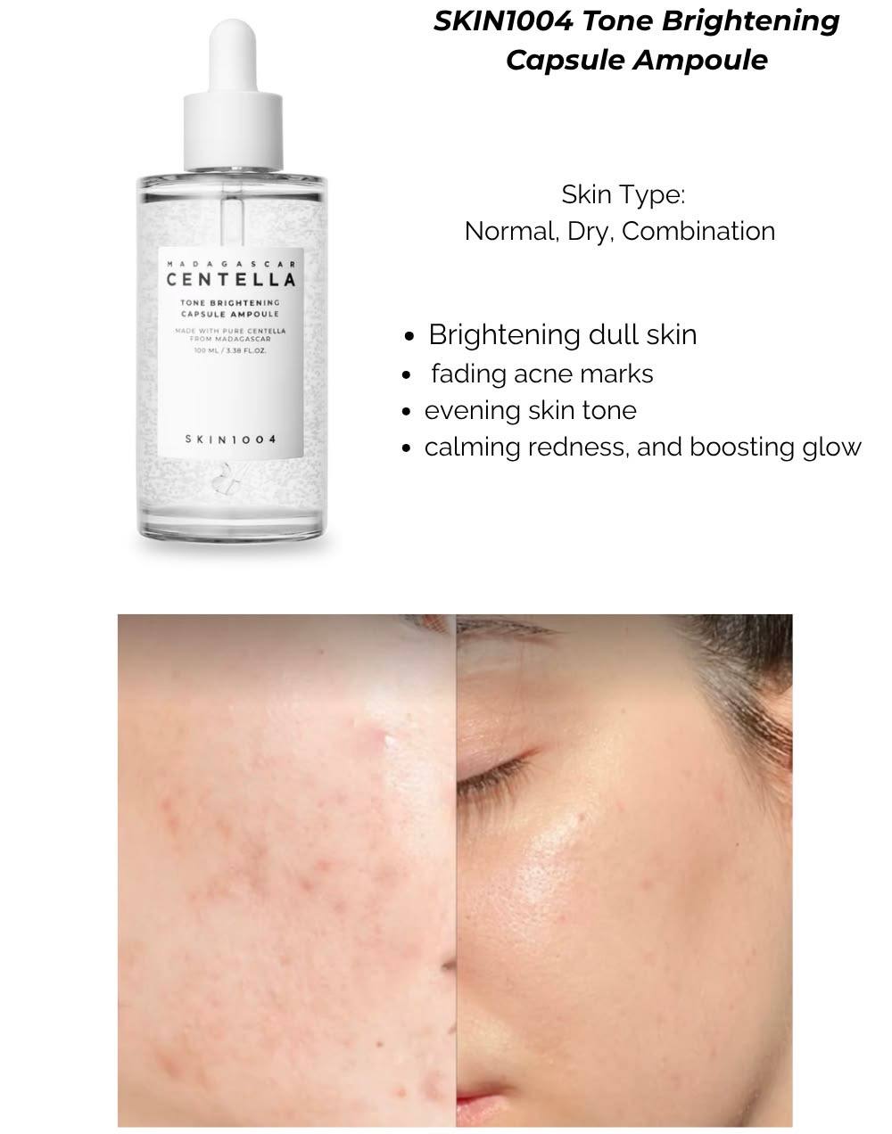 Skin1004 Madagascar Centella Tone Brightening Capsule Ampoule